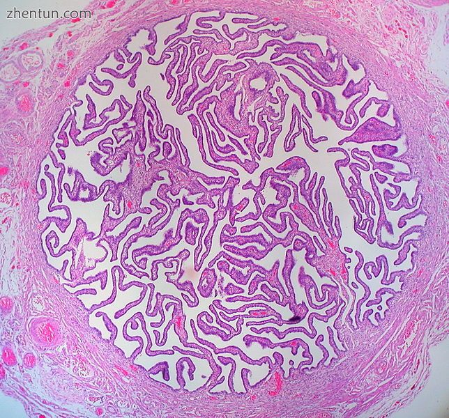 Cross-section of Fallopian tube, stained and viewed under microscope.jpg