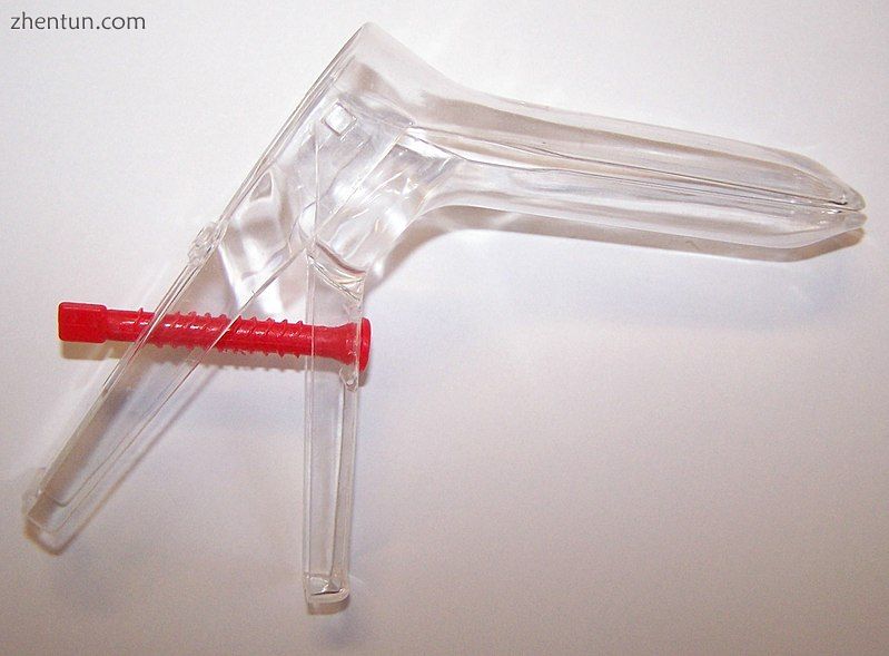 The disposable bivalved plastic vaginal speculum is used in office gynecology.jpg