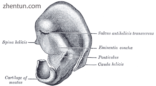 Otoplasty  The cranial surface cartilage of the right ear; the ponticulus (ctr r.png