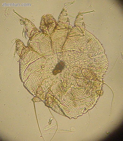A photomicrograph of an itch mite (S. scabiei).jpg
