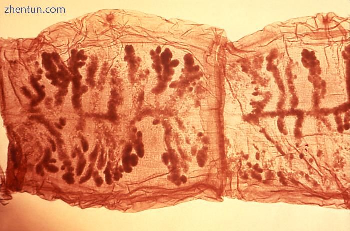 Two proglottids of Taenia solium. This species has 7 to 13 branches of the uteru.jpg