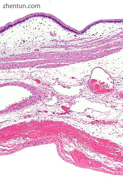 Micrograph of a normal gallbladder wall. H&amp;E stain..jpg