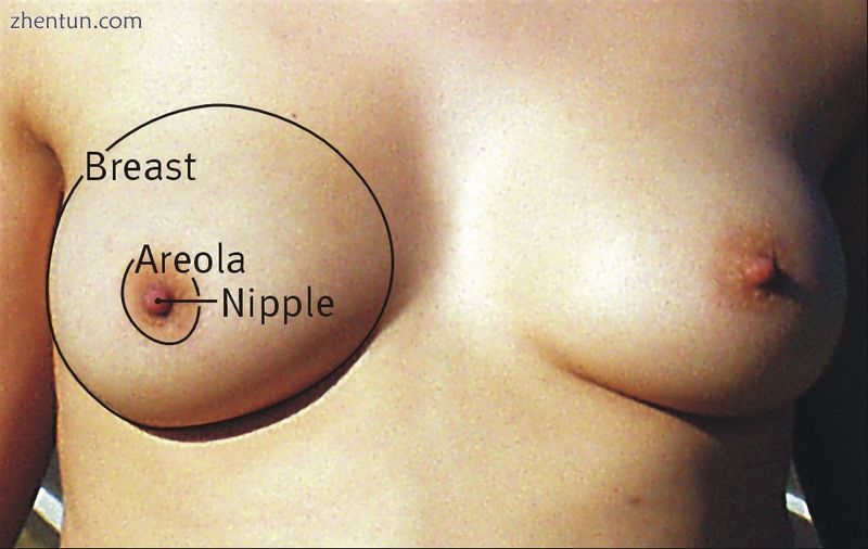 Morphology of human breasts with the areola, nipple, and inframammary fold.jpg