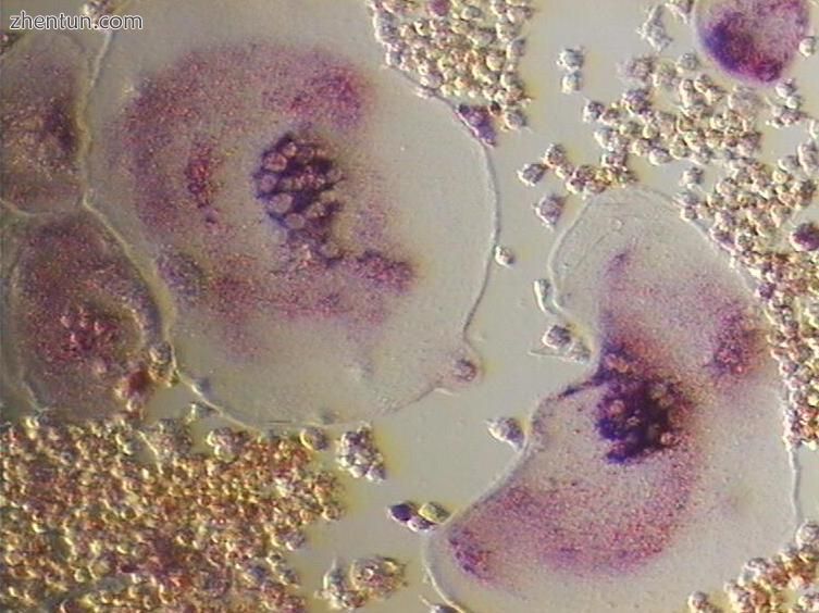 Tartrate resistant acid phosphatase positive osteoclast in cell culture.jpg