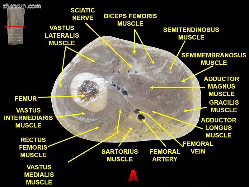 Muscles of thigh. Cross section..jpg