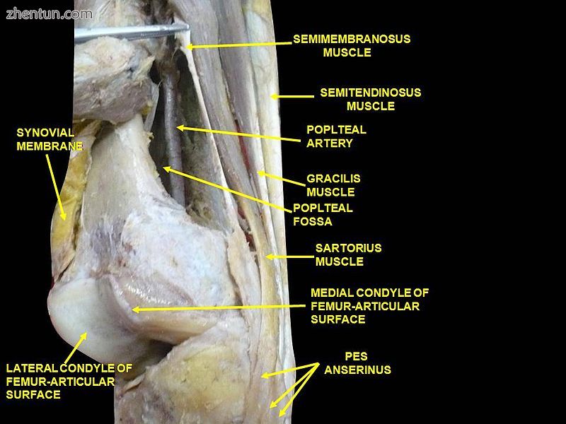 Muscles of thigh. Lateral view..jpg