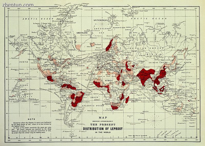 Distribution of leprosy around the world in 1891.jpg
