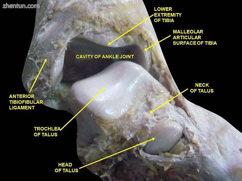 Ankle joint. Deep dissection. Anterior view.jpg