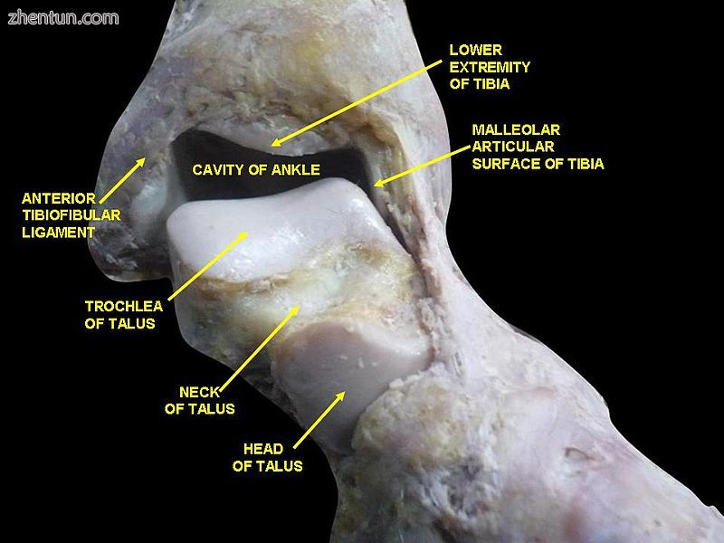 Dorsum of Foot. Ankle joint. Deep dissection..jpg