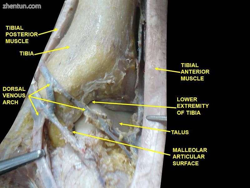 Dorsum of Foot. Ankle joint. Deep dissection.jpg