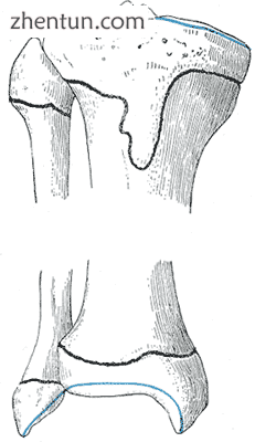Epiphysial lines of tibia and fibula in a young adult. Anterior aspect..png