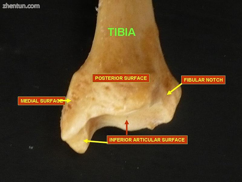 Lower extremity of tibia seen from the back.jpg