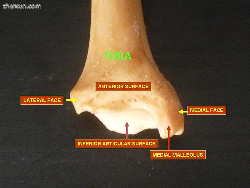 Lower extremity of tibia seen from the front.jpg