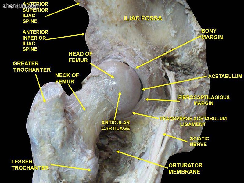 Hip joint. Lateral view. Femur head.jpg