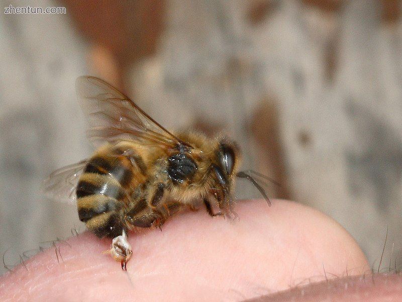 Bee sting. The stinger is torn off and left in the skin..jpg