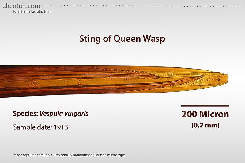 Microscope magnified image of a queen wasp&#039;s stinger.jpg