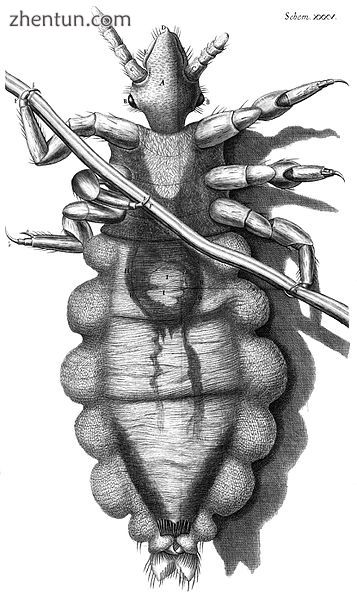 Drawing of a louse clinging to a human hair. Robert Hooke, Micrographia, 1667.jpg