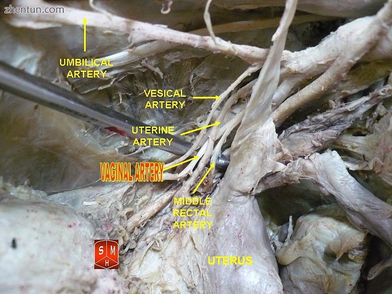 Vaginal artery.jpg