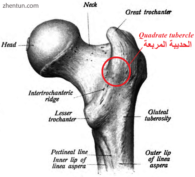 Right femur. Posterior surface. (Quadratus femoris labeled.).png
