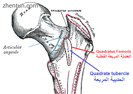 Right femur. Posterior surface. (Quadratus femoris and Quadrate tubercle labeled.).png