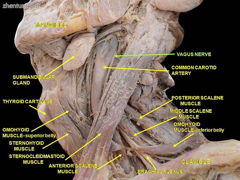 Deep dissection of vagus nerve.JPG