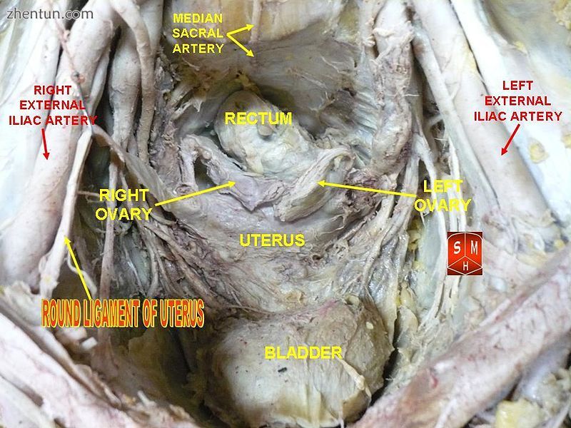 Round ligament of uterus.jpg
