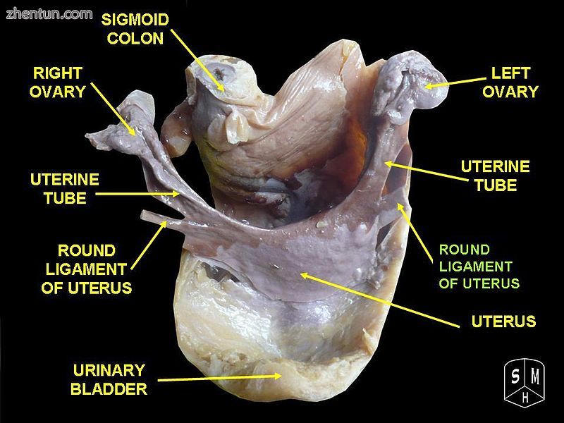 Round ligament of uterus2.jpg