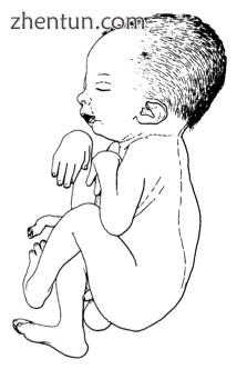 Drawing of an infant with 关节弯曲.png