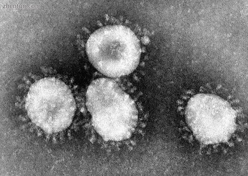 Electron micrograph of coronavirus virions.jpg