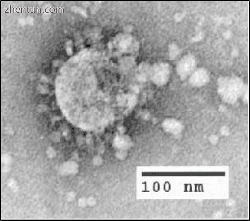 Electron micrograph of SARS coronavirus virion.gif