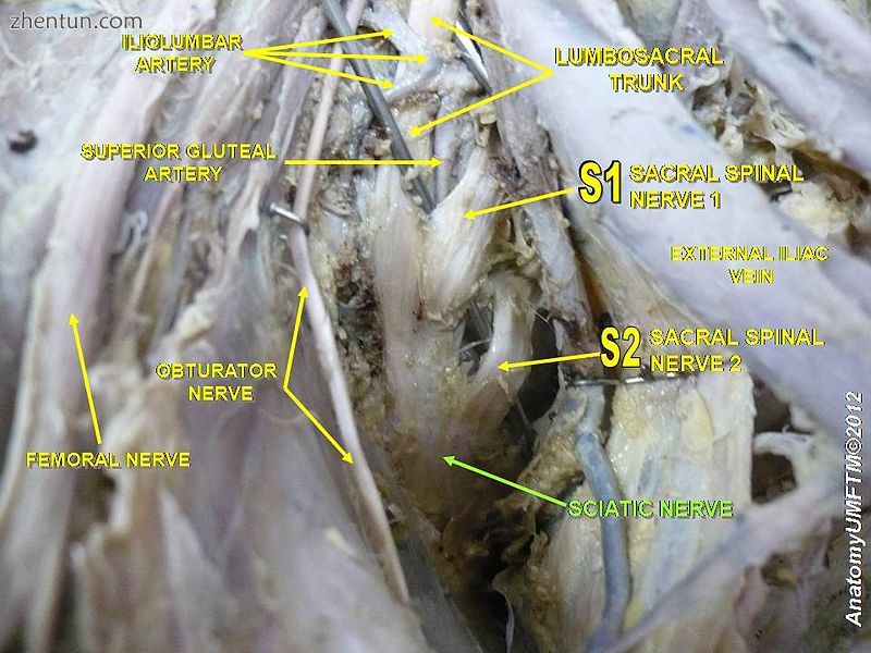 Sciatic nerve.3.jpg