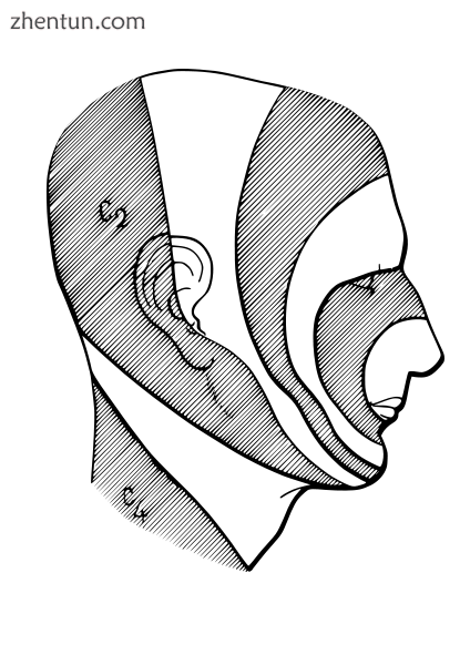Onion-skin distribution of the trigeminal nerve.png