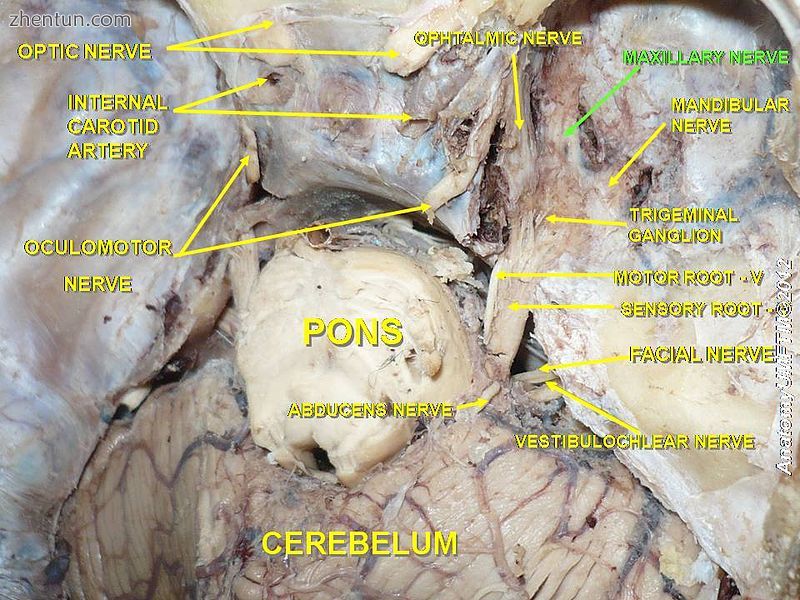 Maxillary nerve.jpg