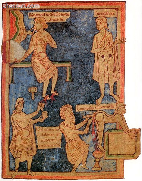 An 11th-century English miniature: On the right is an operation to remove hemorrhoids.