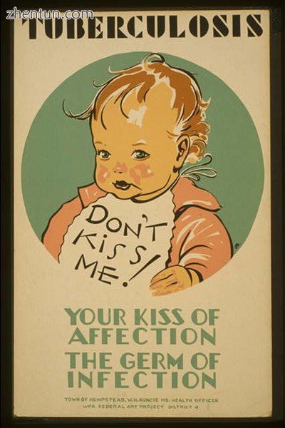 Tuberculosis prevention poster from the United States, c. 1940