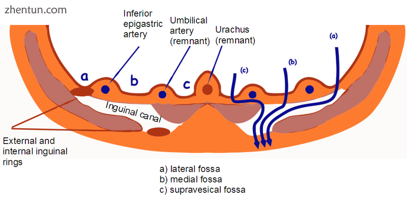 Inguinal fossae