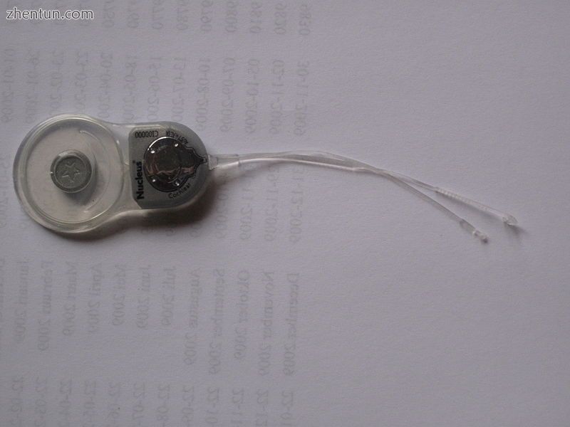 The internal part of a cochlear implant (model Cochlear Freedom 24 RE)