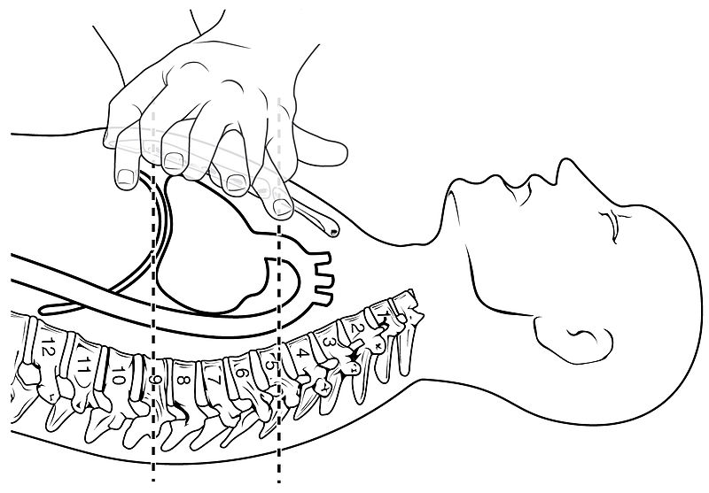 CPR technique as demonstrated on a dummy