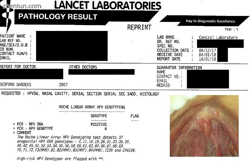 A sample DNA test report for HPV Genotype from a laboratory