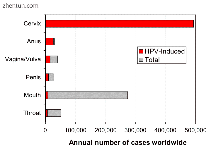 HPV-induced cancers