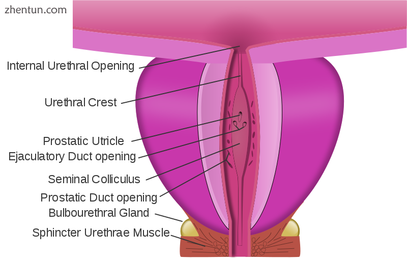 Dissection of prostate showing prostatic urethra.