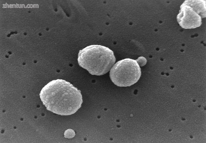 The bacterium Streptococcus pneumoniae, a common cause of pneumonia, imaged by an electron microscop ...