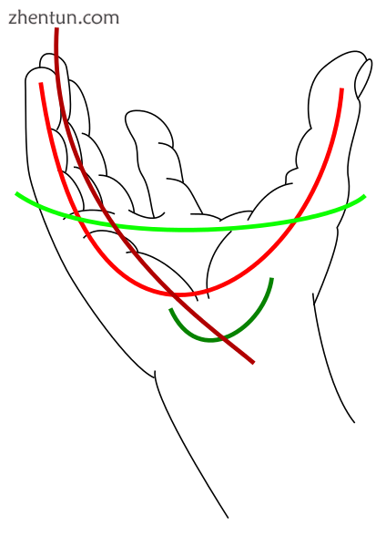 Arches of the hand Red: one of the oblique arches Brown: one of the longitudinal arches of the digit ...