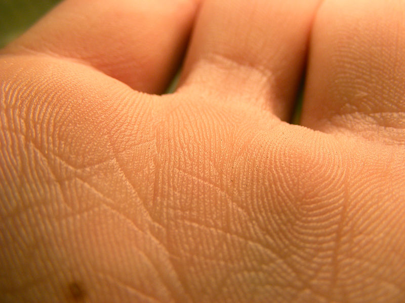 Left: papillary ridges of palm Right: sexual dimorphism