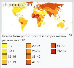 Deaths from peptic ulcer disease per million persons in 2012