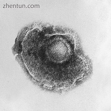 Structure of chickenpox virus. They have a lipid envelope