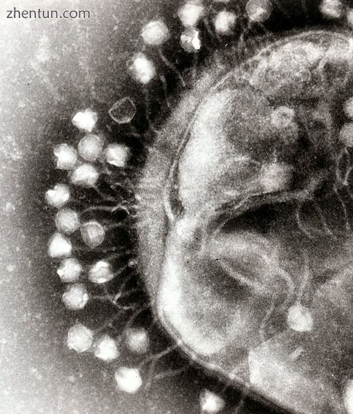 Transmission electron micrograph of multiple bacteriophages attached to a bacterial cell wall