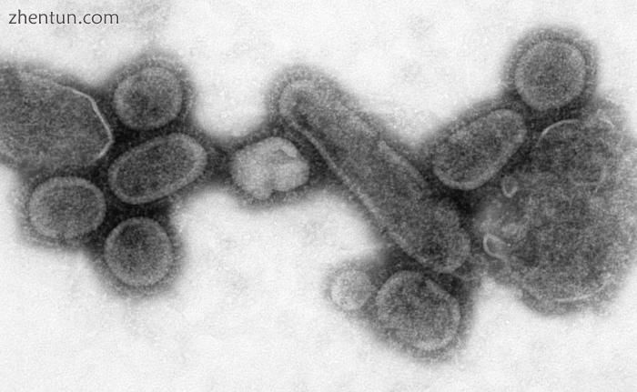 Transmission electron microscope image of a recreated 1918 influenza virus