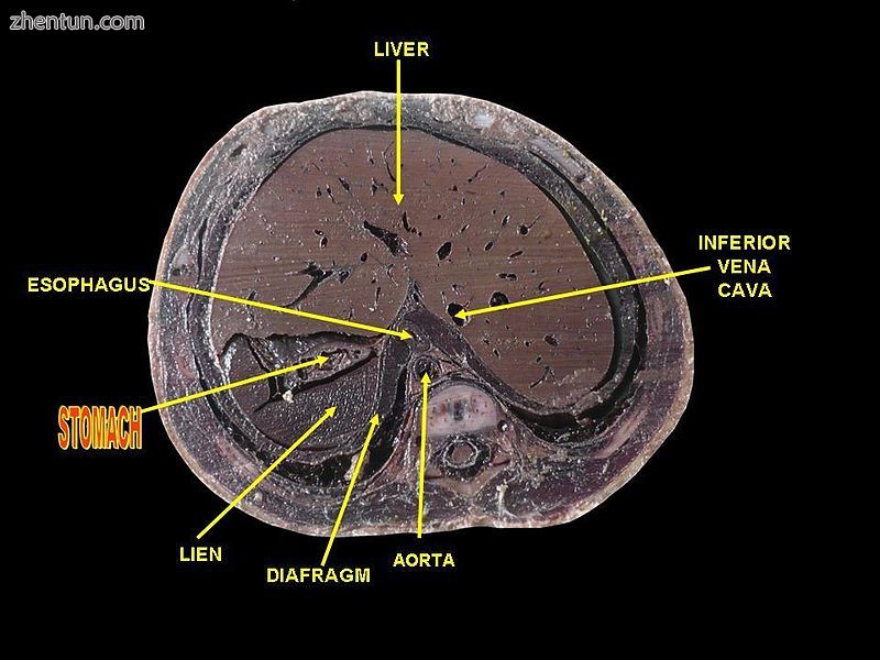 Human stomach