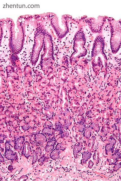 Micrograph showing a cross section of the human stomach wall in the body portion of the stomach. H . ...